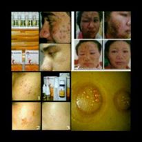 Melia 2